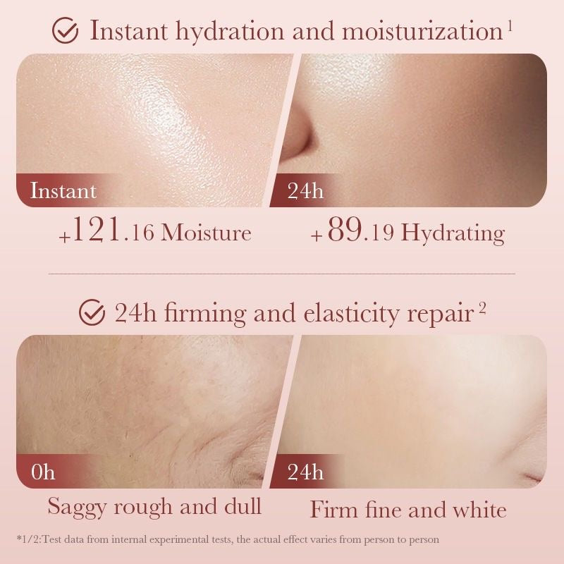 سێتی چاڤدێریا پێستی كاميليا