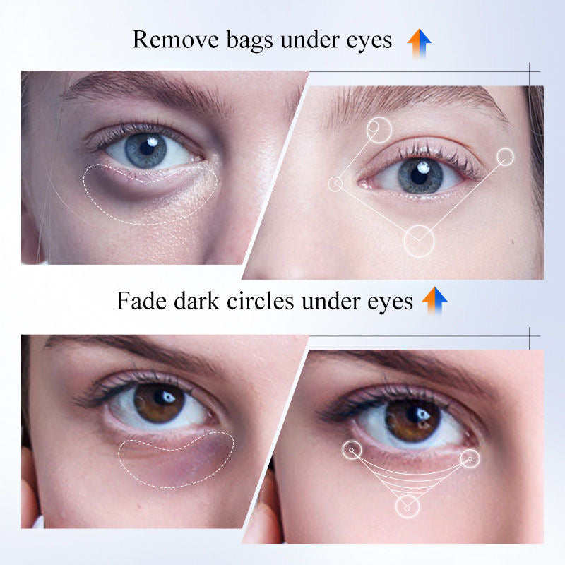  کرێما دژی چربونا بن چاڤا