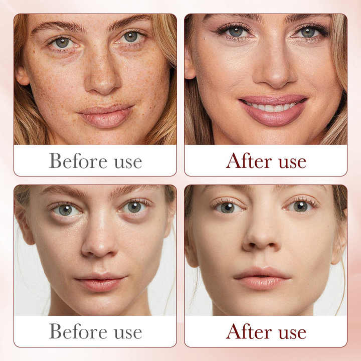  سیرومێ خوێنی ئەژدەهای ڕێیشی