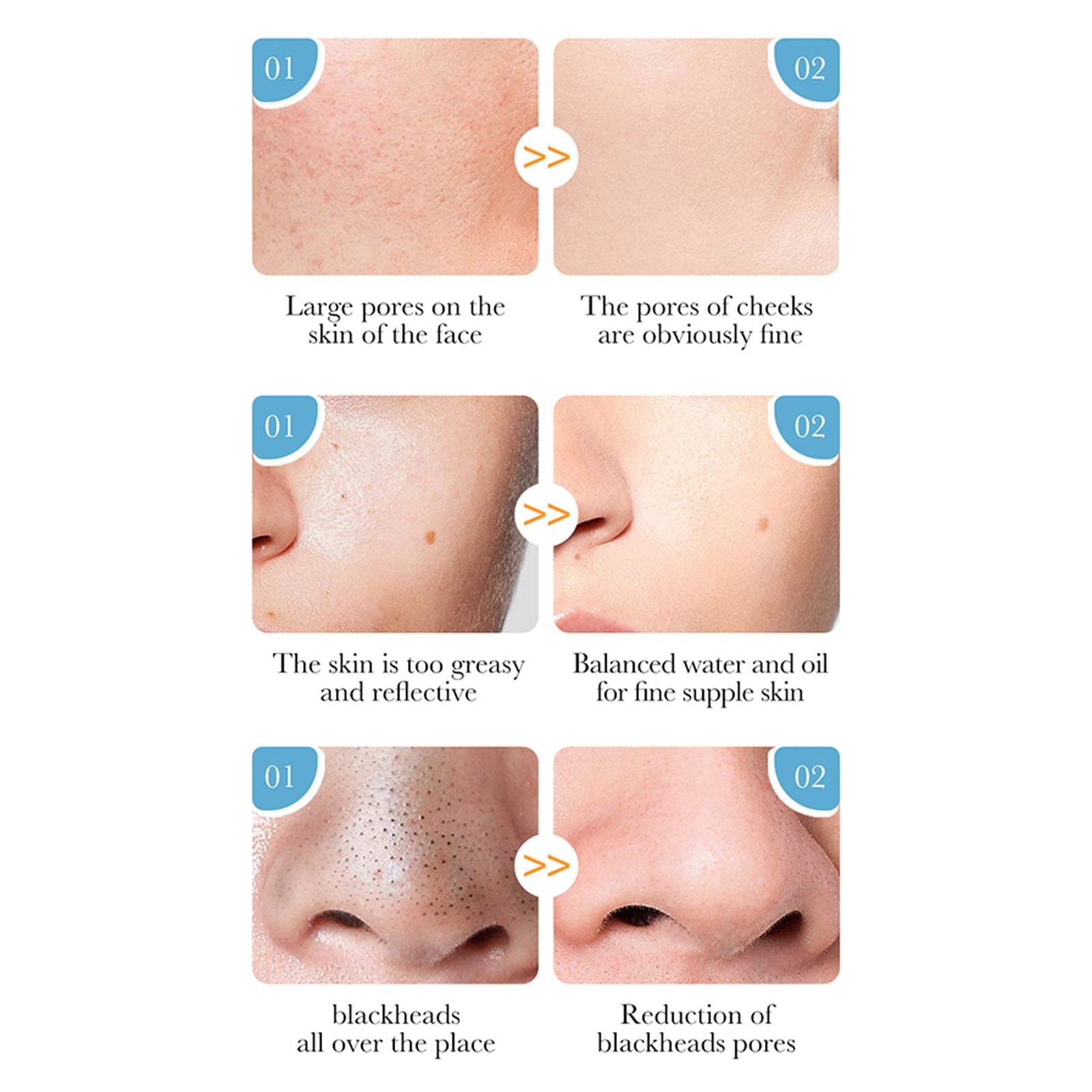 قناع الطين الصبار