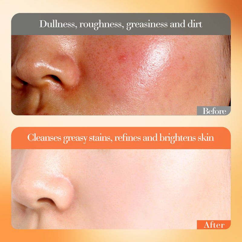 مجموعة تبييض وتفتيح البشرة بفيتامين سي