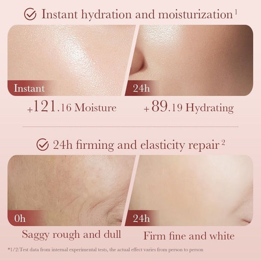  سێتی چاڤدێریا پێستی كاميليا