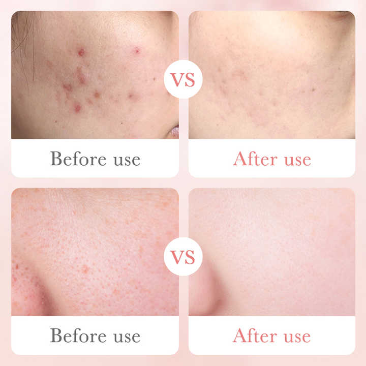 مجموعة العناية بالبشرة بالورد