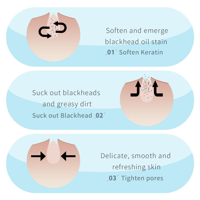 مجموعة قناع إزالة الرؤوس السوداء بخلاصة الصبار