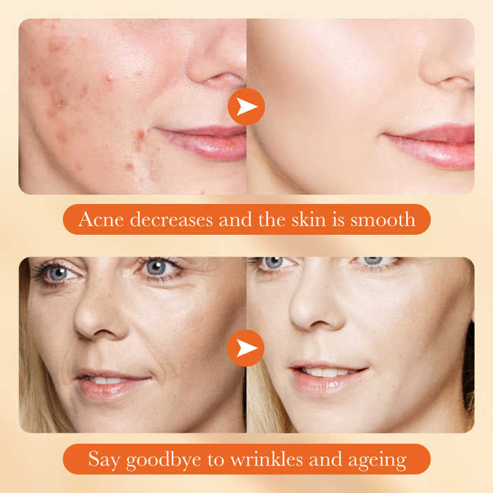 پاقشکەرێ ناڤ چاڤا یێ شوفانێ